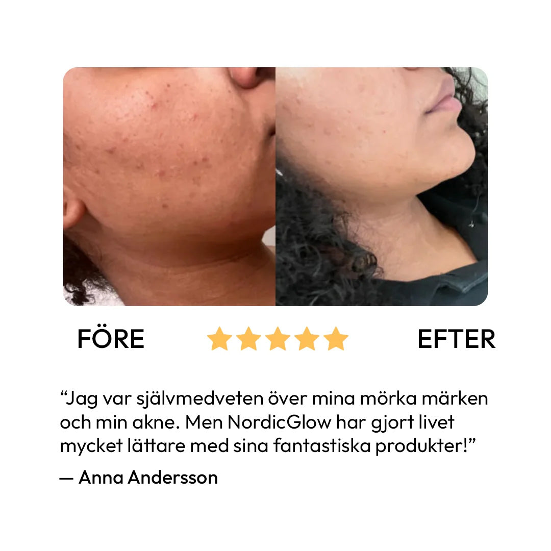 Tvål med Citron-, gurkmeja- & kojicsyra