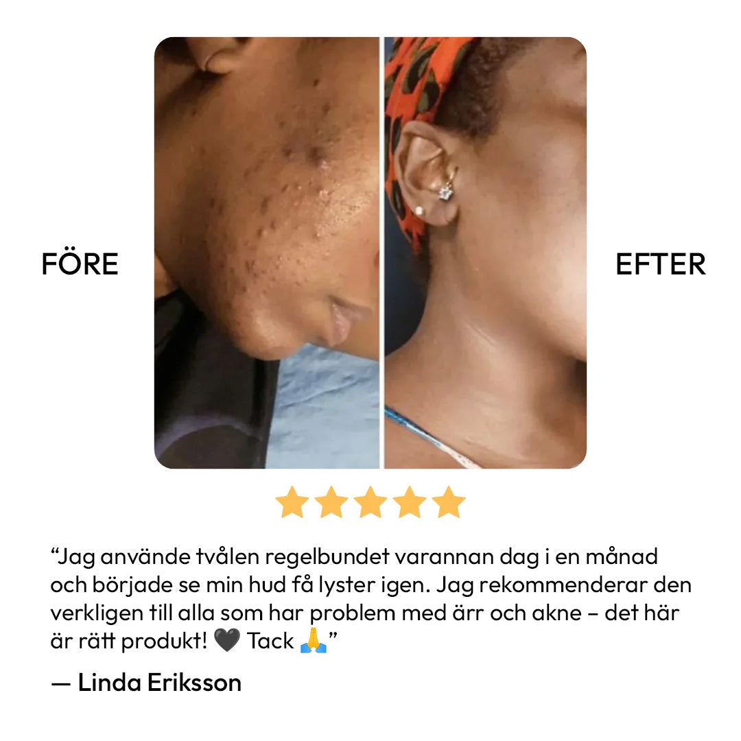 Tvål med Citron-, gurkmeja- & kojicsyra